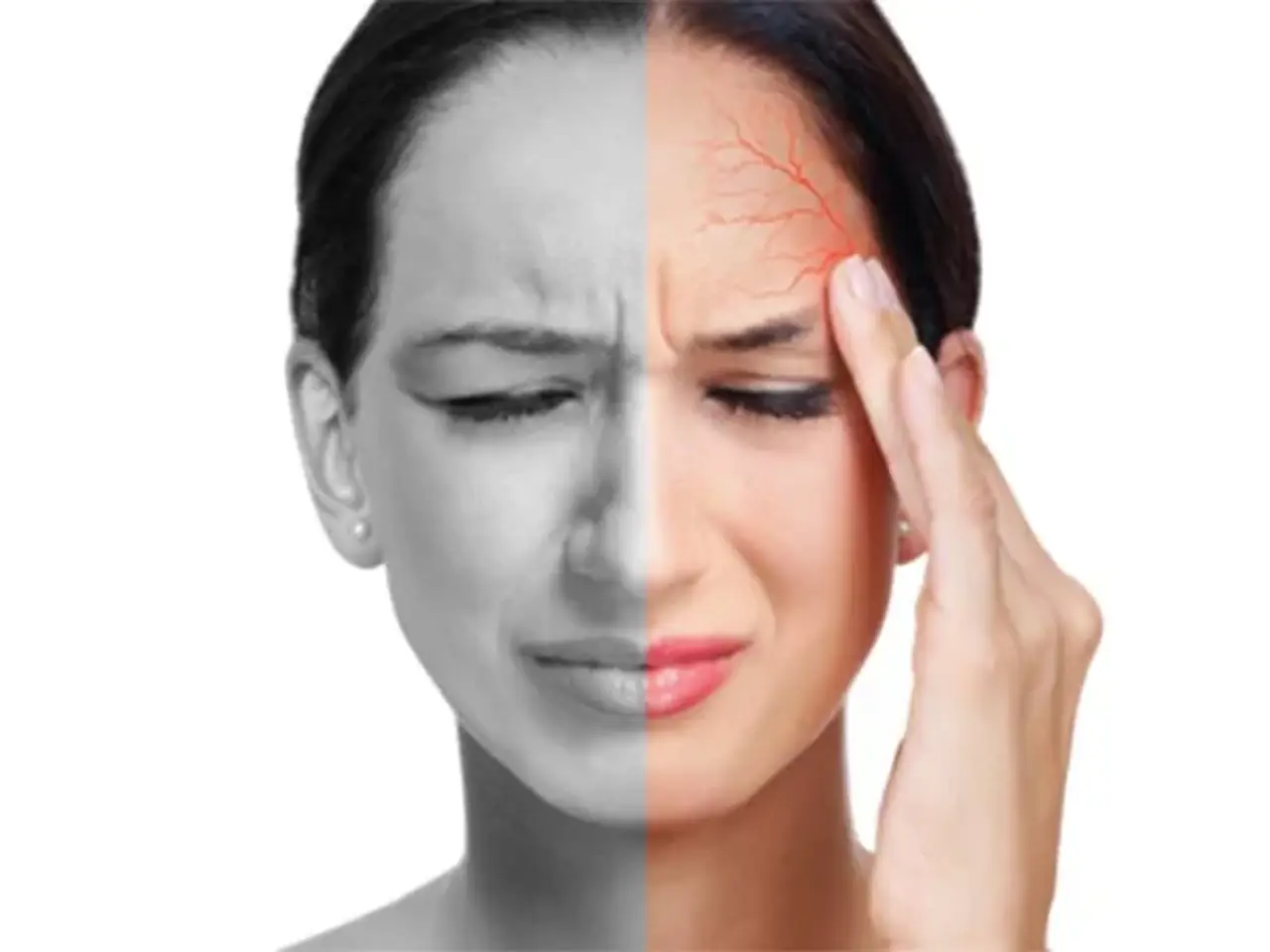 Điều trị đau đầu migraine (đau nửa đầu)