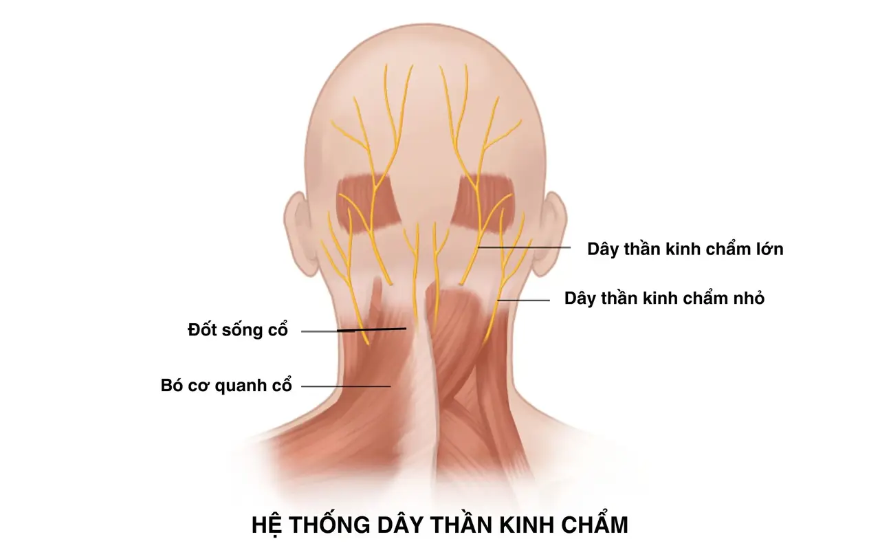 Điều trị đau dây thần kinh